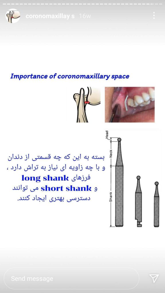 cornomaxillary space